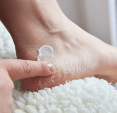 What to do to combat dry feet
